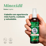 Tónico Minoxidil - Shanatural's